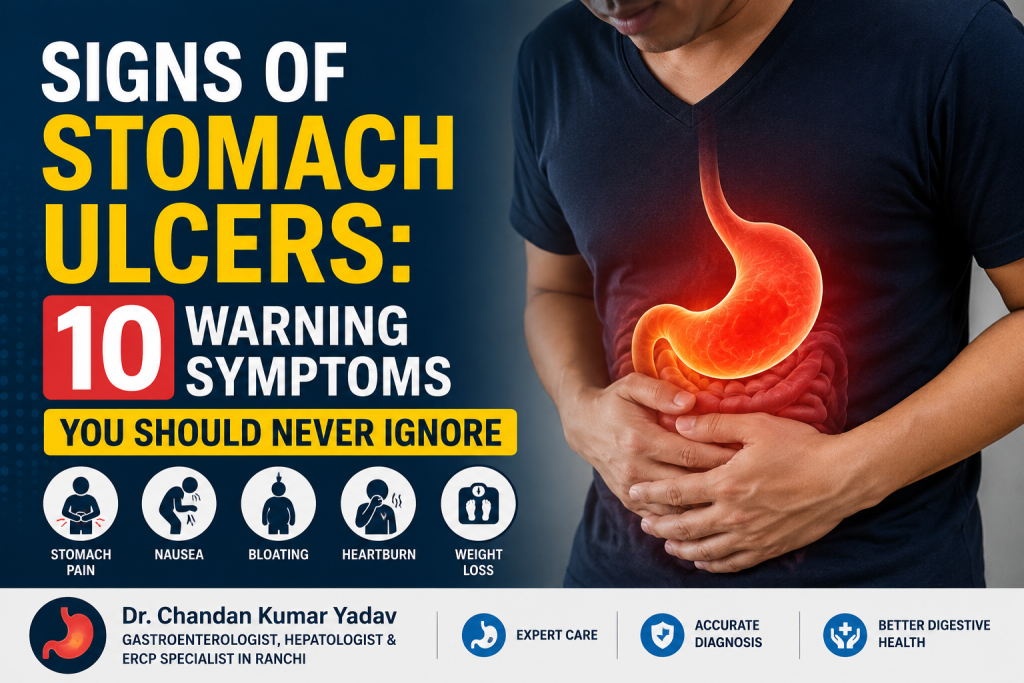 Signs of Stomach Ulcers
